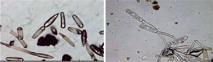 عامل بیماری سفیدک سطحی یونجه